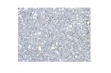 Effet granit gris
